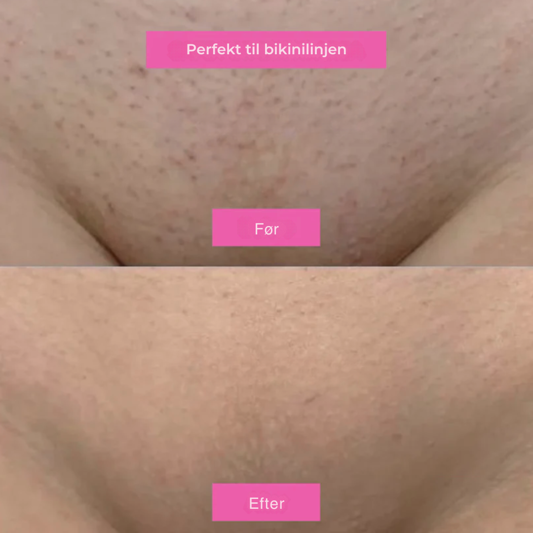 Hårfjerningsolie – Naturligt glat hud uden skraber